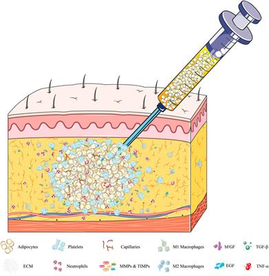 Recent Developments in Extracellular Matrix Remodeling for Fat Grafting